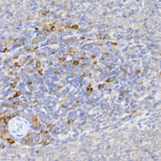 KMT2E Antibody in Immunohistochemistry (Paraffin) (IHC (P))