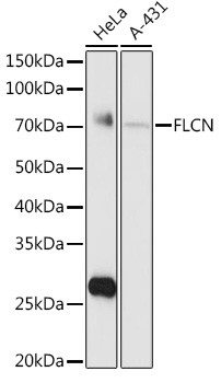 Folliculin Antibody in Western Blot (WB)