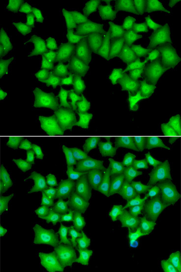 CPSF3L Antibody in Immunocytochemistry (ICC/IF)