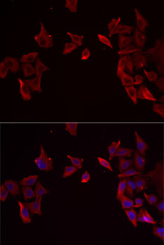 RAMP3 Antibody in Immunocytochemistry (ICC/IF)