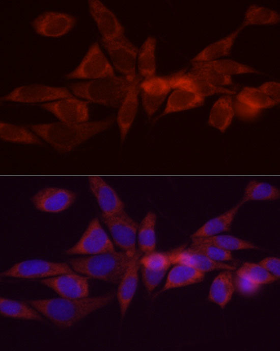 DGAT1 Antibody in Immunocytochemistry (ICC/IF)