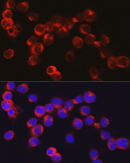 DEFA1 Antibody in Immunocytochemistry (ICC/IF)
