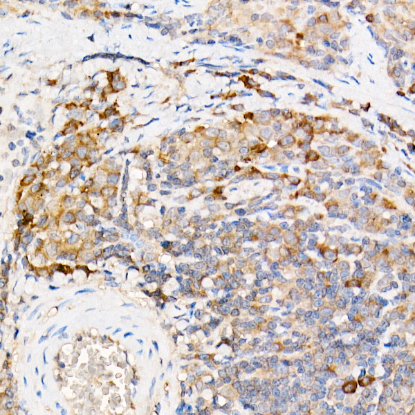 TES Antibody in Immunohistochemistry (Paraffin) (IHC (P))