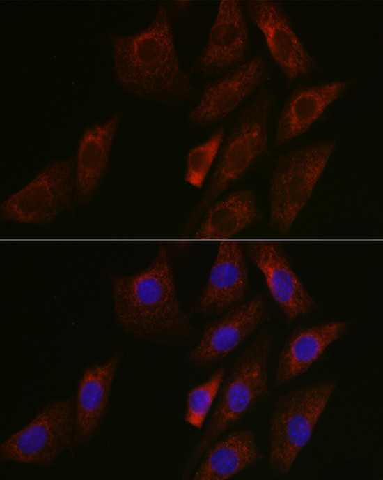 SIRT3 Antibody in Immunocytochemistry (ICC/IF)