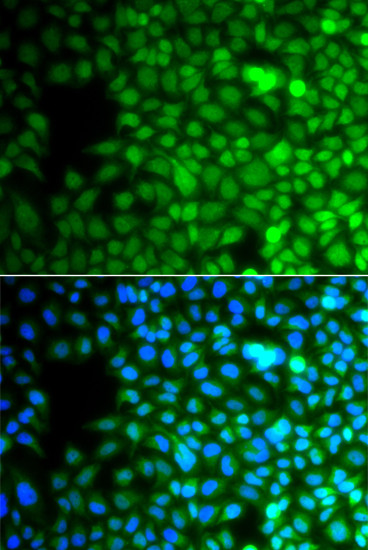 ZNF195 Antibody in Immunocytochemistry (ICC/IF)