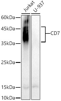 CD7 Antibody in Western Blot (WB)