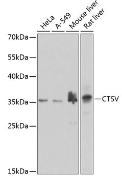 Cathepsin V Antibody in Western Blot (WB)