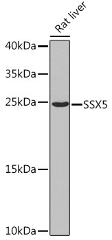 SSX5 Antibody in Western Blot (WB)