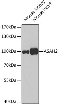 ASAH2 Antibody in Western Blot (WB)