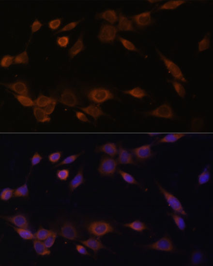 Cytochrome P450 Reductase Antibody in Immunocytochemistry (ICC/IF)