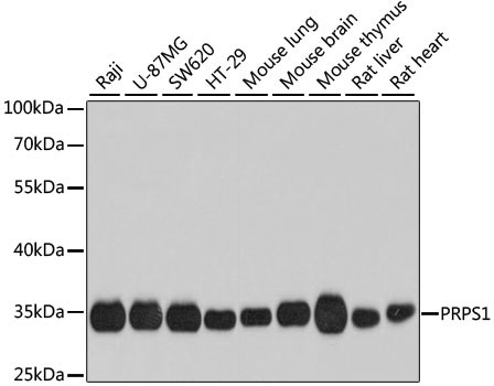 PRPS1 Antibody in Western Blot (WB)