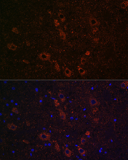 SLC5A7 Antibody in Immunohistochemistry (Paraffin) (IHC (P))