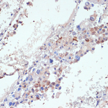 WNT5B Antibody in Immunohistochemistry (Paraffin) (IHC (P))