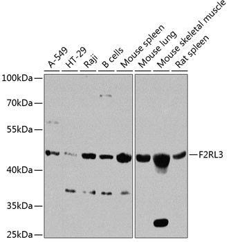 Protease-Activated Receptor-4 Antibody in Western Blot (WB)