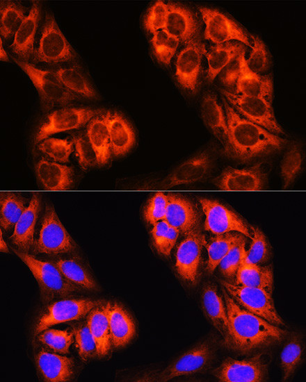 MTHFD1 Antibody in Immunocytochemistry (ICC/IF)