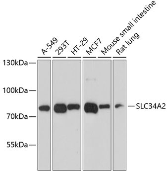 SLC34A2 Antibody in Western Blot (WB)