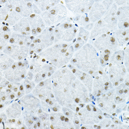 GATAD2B Antibody in Immunohistochemistry (Paraffin) (IHC (P))