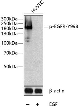 Phospho-EGFR (Tyr998) Antibody in Western Blot (WB)