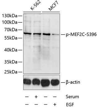 Phospho-MEF2C (Ser396) Antibody in Western Blot (WB)