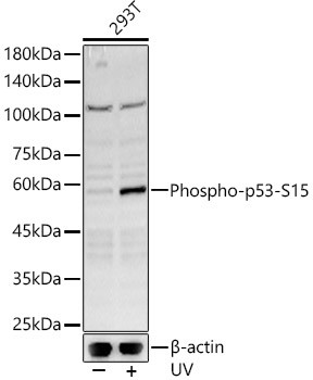 Phospho-p53 (Ser15) Antibody in Western Blot (WB)