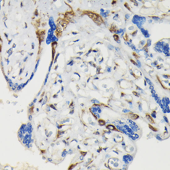 Phospho-VASP (Ser239) Antibody in Immunohistochemistry (Paraffin) (IHC (P))