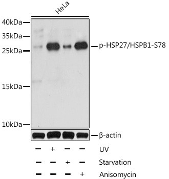Phospho-HSP27 (Ser78) Antibody in Western Blot (WB)