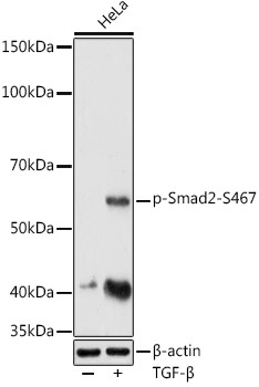 Phospho-SMAD2 (Ser465, Ser467) Antibody in Western Blot (WB)