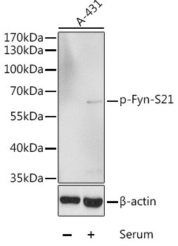 Phospho-Fyn (Ser21) Antibody in Western Blot (WB)
