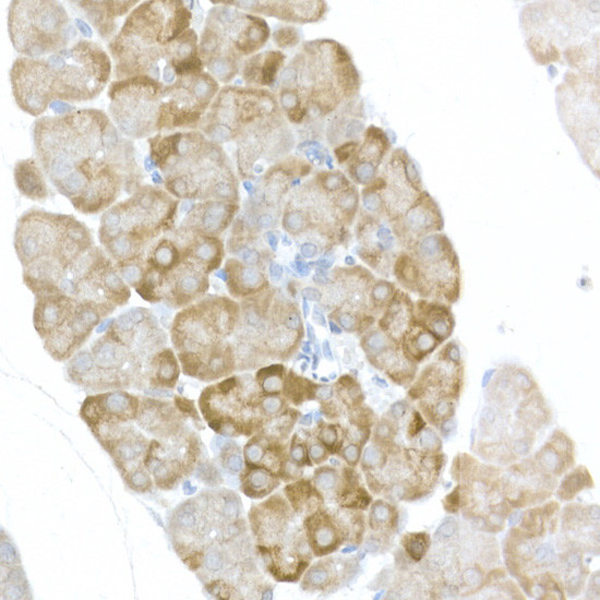 Phospho-S6 (Ser240, Ser244) Antibody in Immunohistochemistry (Paraffin) (IHC (P))