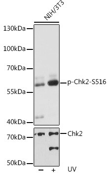Phospho-CHK2 (Ser516) Antibody in Western Blot (WB)