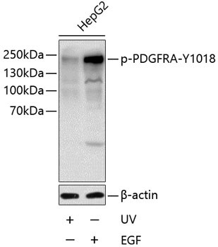 Phospho-PDGFRA (Tyr1018) Antibody in Western Blot (WB)
