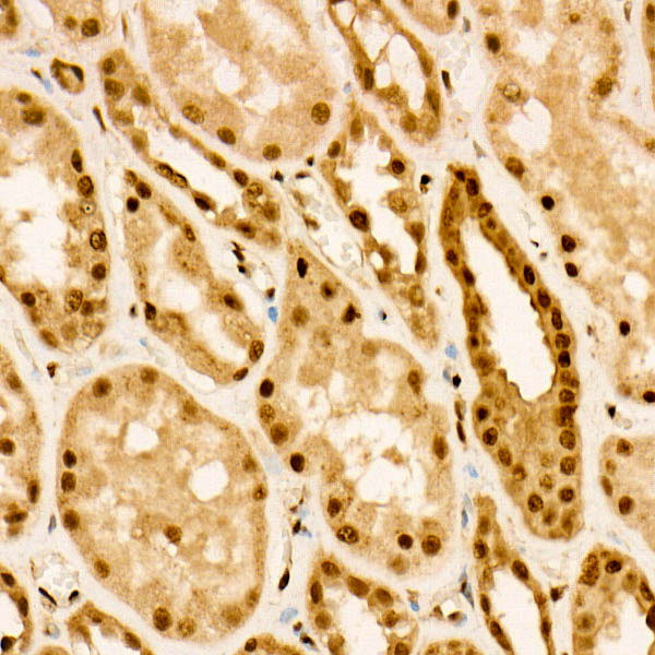 Phospho-FOXO3A (Ser253) Antibody in Immunohistochemistry (Paraffin) (IHC (P))