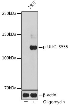 Phospho-ULK1 (Ser555) Antibody in Western Blot (WB)