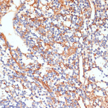 Phospho-Vimentin (Ser39) Antibody in Immunohistochemistry (Paraffin) (IHC (P))