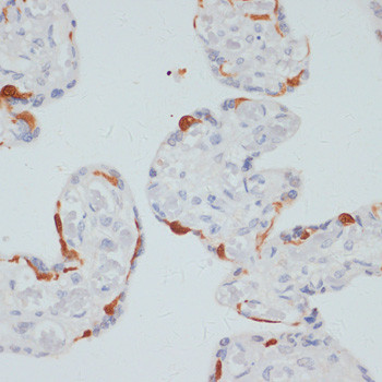Phospho-PLCG1 (Ser1248) Antibody in Immunohistochemistry (Paraffin) (IHC (P))