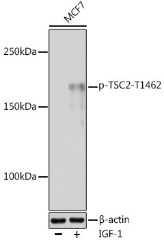 Phospho-TSC2 (Thr1462) Antibody in Western Blot (WB)