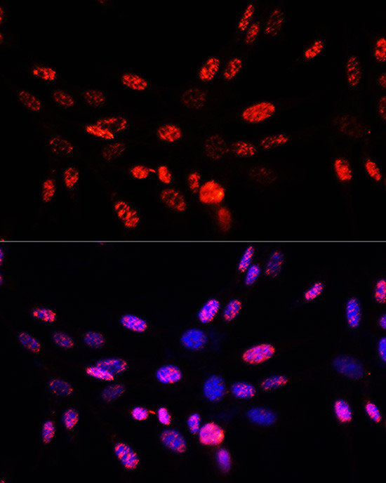 Phospho-Histone H3 (Thr45) Antibody in Immunocytochemistry (ICC/IF)