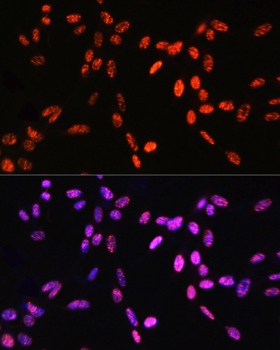 Phospho-Histone H3 (Thr6) Antibody in Immunocytochemistry (ICC/IF)