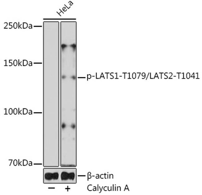Phospho-LATS1/LATS2 (Thr1079, Thr1041) Antibody in Western Blot (WB)