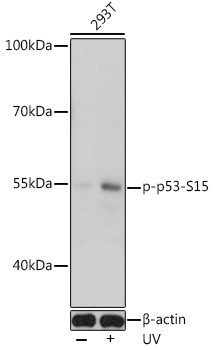 Phospho-p53 (Ser15) Antibody in Western Blot (WB)