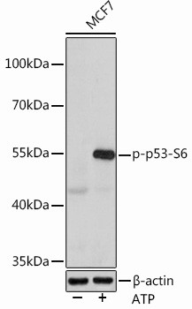 Phospho-p53 (Ser6) Antibody in Western Blot (WB)