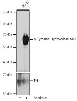 Phospho-Tyrosine Hydroxylase (Ser40) Antibody in Western Blot (WB)