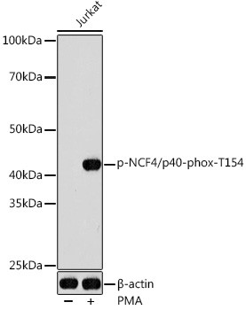 Phospho-NCF4 (Thr154) Antibody in Western Blot (WB)
