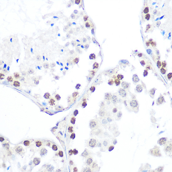 Phospho-AMPK beta-1 (Ser182) Antibody in Immunohistochemistry (Paraffin) (IHC (P))