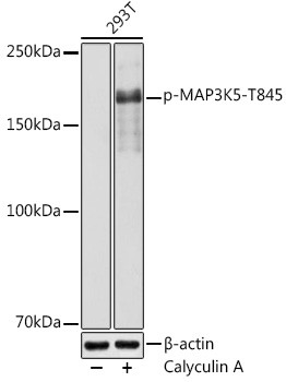 Phospho-ASK1 (Thr845) Antibody in Western Blot (WB)