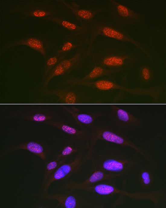 Phospho-c-Jun (Thr91) Antibody in Immunocytochemistry (ICC/IF)