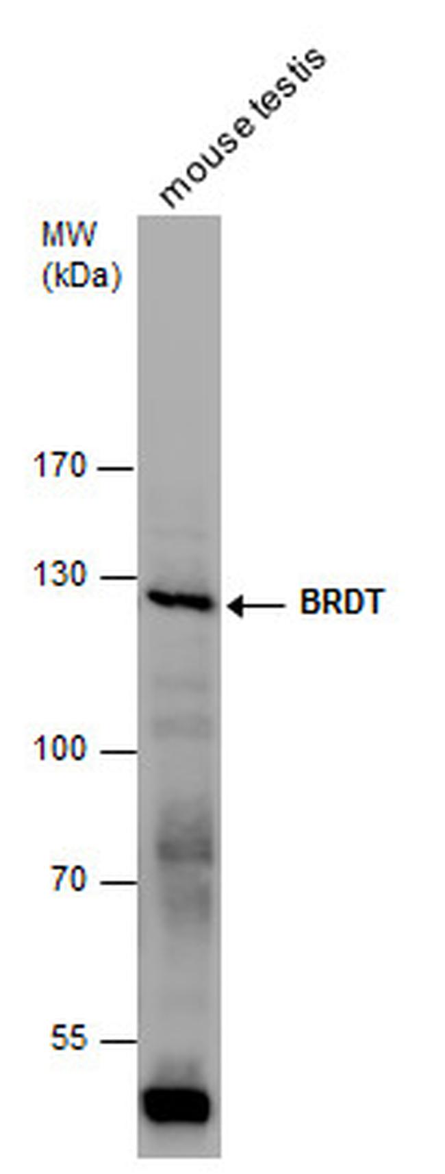 BRDT Antibody in Western Blot (WB)