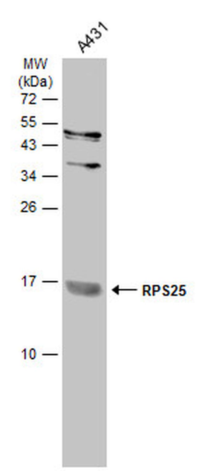 RPS25 Antibody in Western Blot (WB)