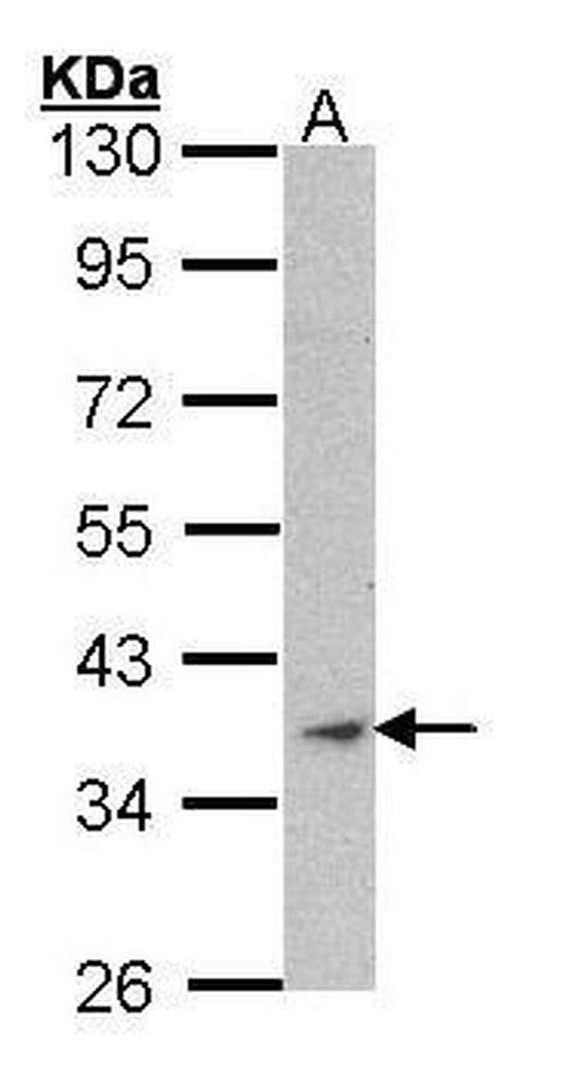 ACTA1 Antibody in Western Blot (WB)