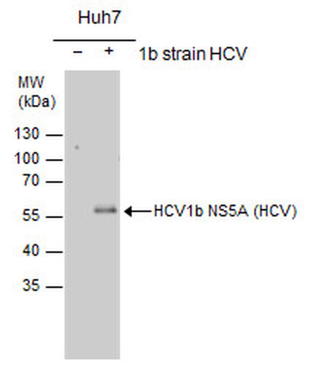 Hepatitis C Virus NS5a Antibody in Western Blot (WB)